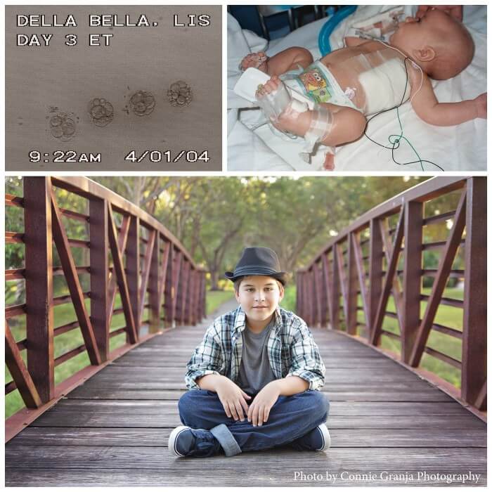 A collage of two pictures: the top shows a newborn baby with medical tubes in a hospital, labeled "DELLA BELLA, LIS DAY 3 ET" with a timestamp "9:22 AM 4/01/04". The bottom shows a young boy sitting on a wooden bridge, wearing a plaid shirt and a black hat. Photo: Connie Granja Photography.
